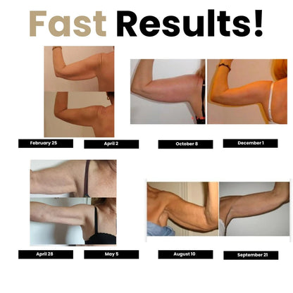 3D Compression Sleeves – Say Goodbye to Arm Jiggle